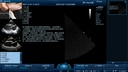 Vetus M11 view 4
