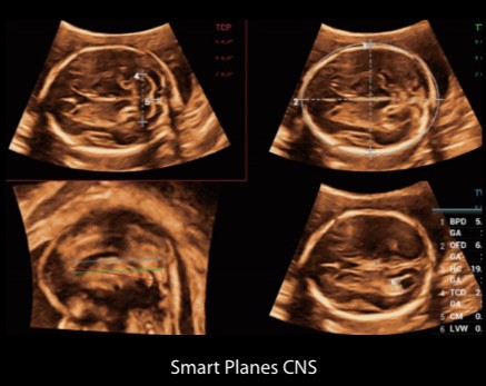 Smart Planes CNS - Софтуер за ехограф Mindray