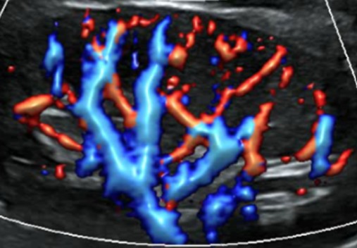 Glazing Flow - Софтуер за ехограф Mindray