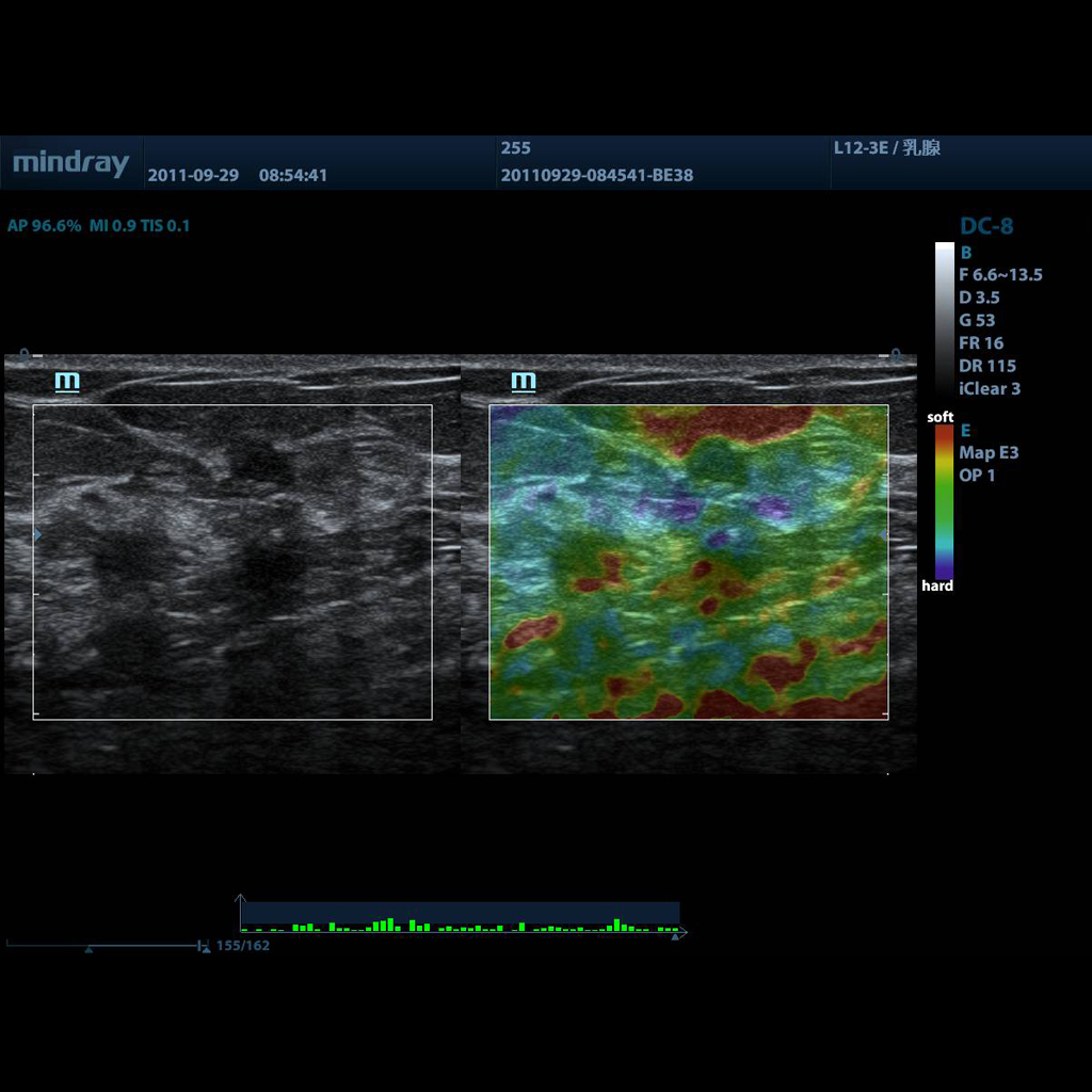 Natural Touch Elastography - Софтуер за ветеринарен ехограф Mindray