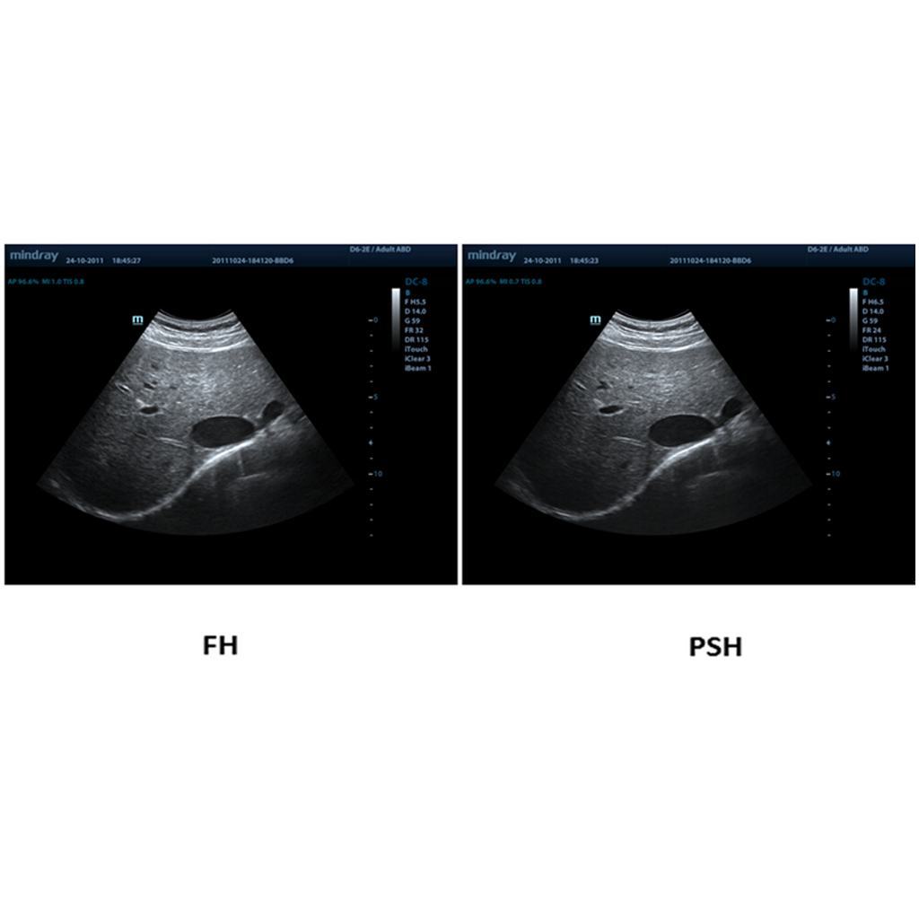 PSH™  - Софтуер за ветеринарен ехограф Mindray