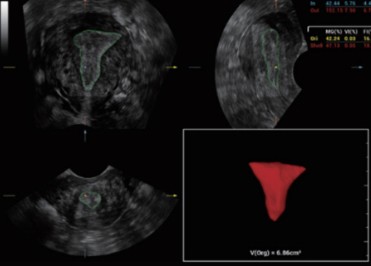 [119061725] Smart V Trace - Софтуер за ехограф Mindray