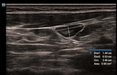 [119061727] Smart Trace - Софтуер за ехограф Mindray