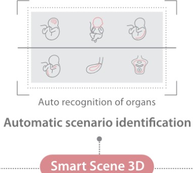[119061728] Smart Scene 3D - Софтуер за ехограф Mindray