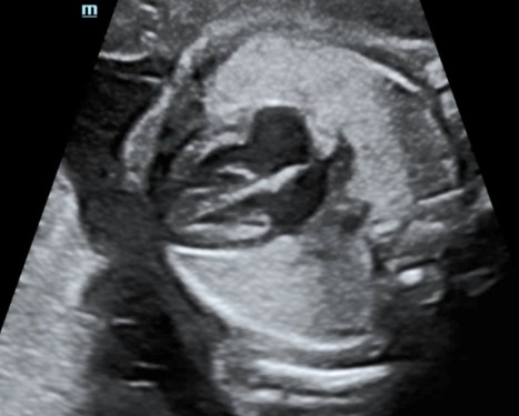 [119061734] Smart Fetal HR - Софтуер за ехограф Mindray