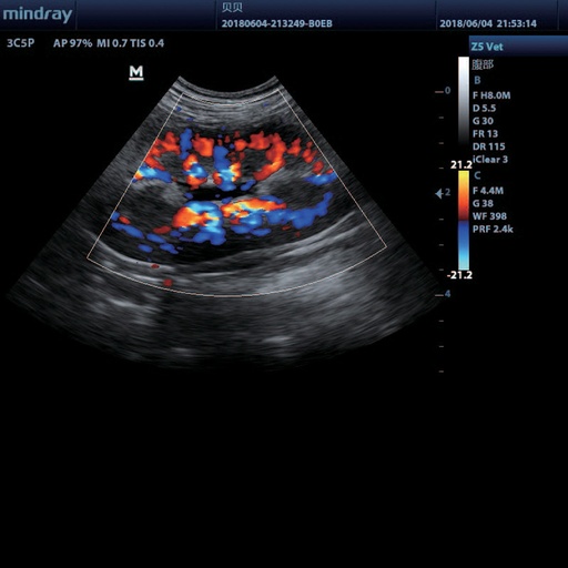 [119061827] B/M/Color/Color M/Power/Directional Power Doppler Flow Imaging