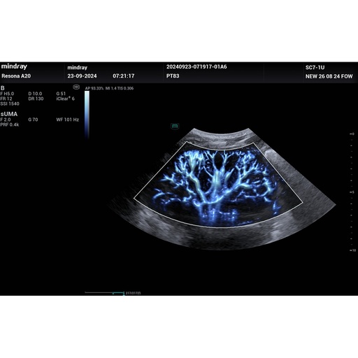 [119061855] UMA - Софтуер за ехограф Mindray