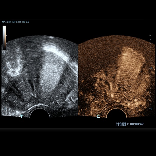 [1571500167] UWN+ Contrast Imaging™ - Софтуер за ветеринарен ехограф Mindray