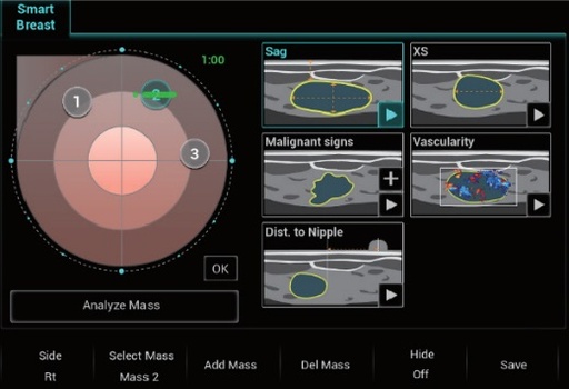 [119061352] Smart Breast - Софтуер за ехограф Mindray