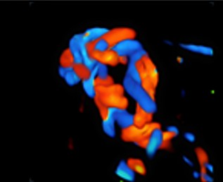 [119061703] Color 3D - Софтуер за ехограф Mindray